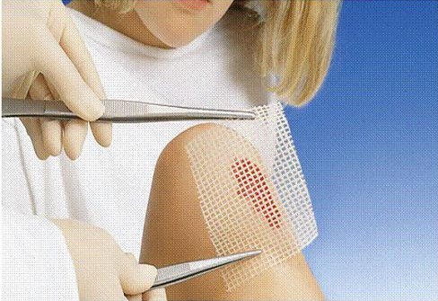 Фото для 8. Первая помощь при ожогах