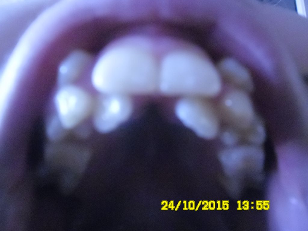 Фото для Подарите улыбку