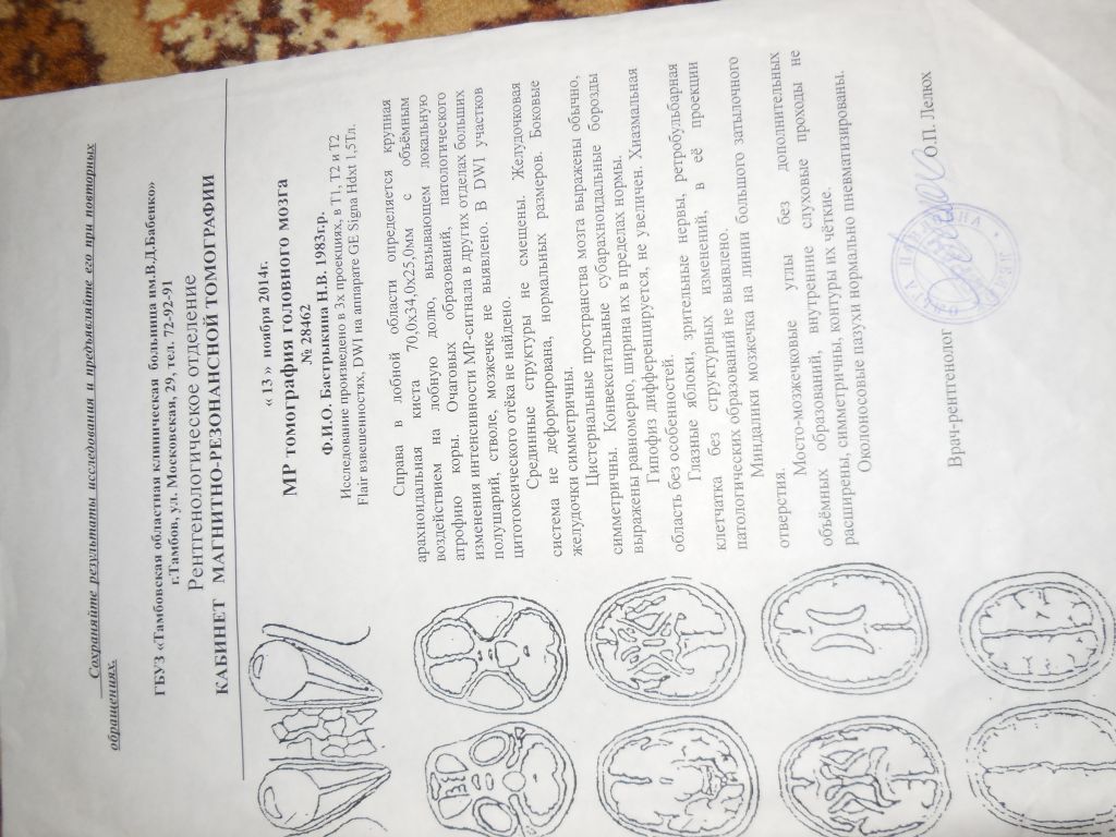 Фото для Опухоль головного мозга и артрозоартрит, необходимо срочно начать лечение