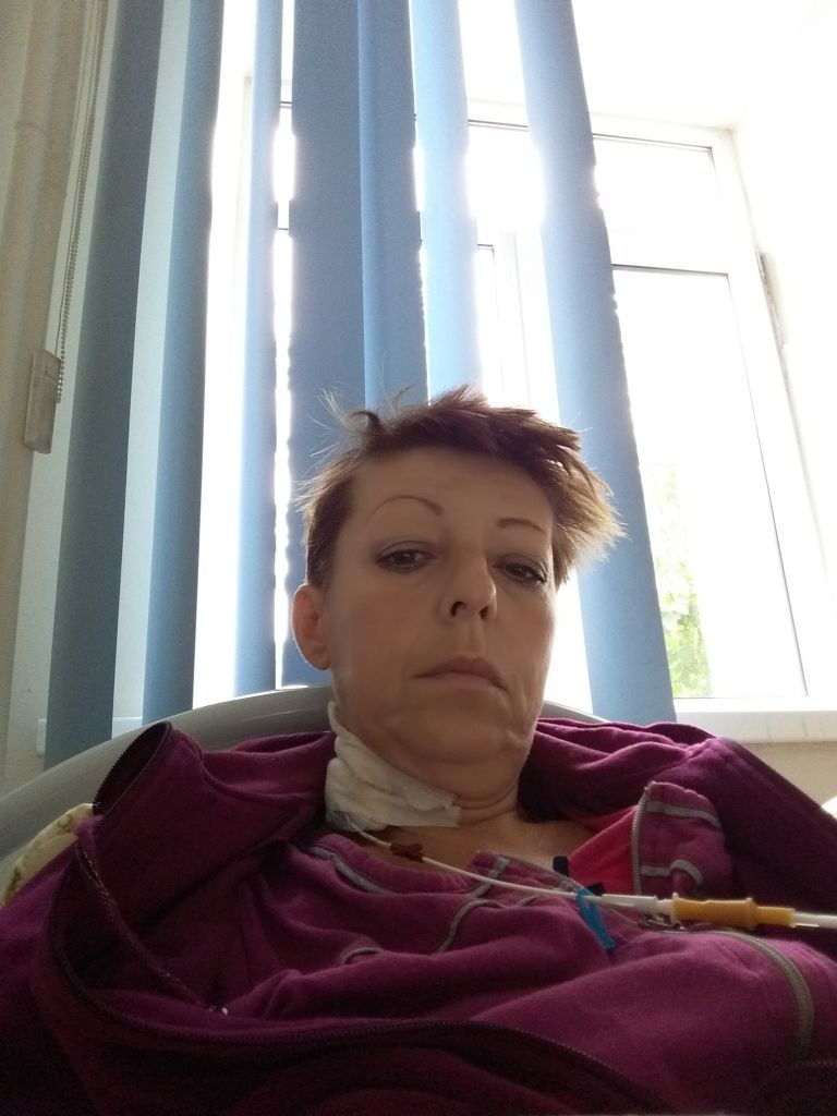 Фото для Реабилитация после операции на желудок