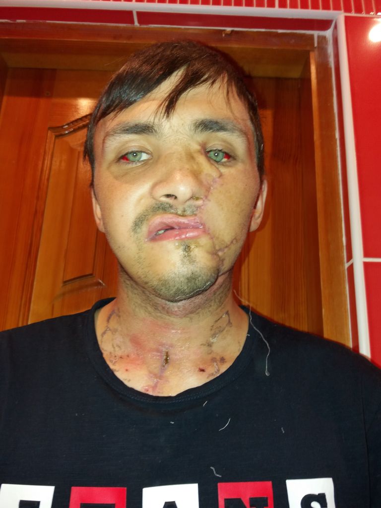 Фото для Помогите восстановить лицо