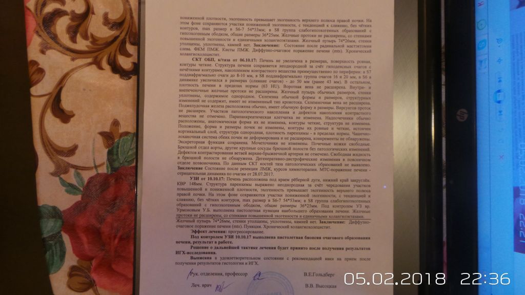 Фото для Страшный диагноз саркома молочной железы. Хочу жить.