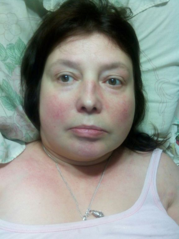 Фото для Помогите спасти мне жизнь