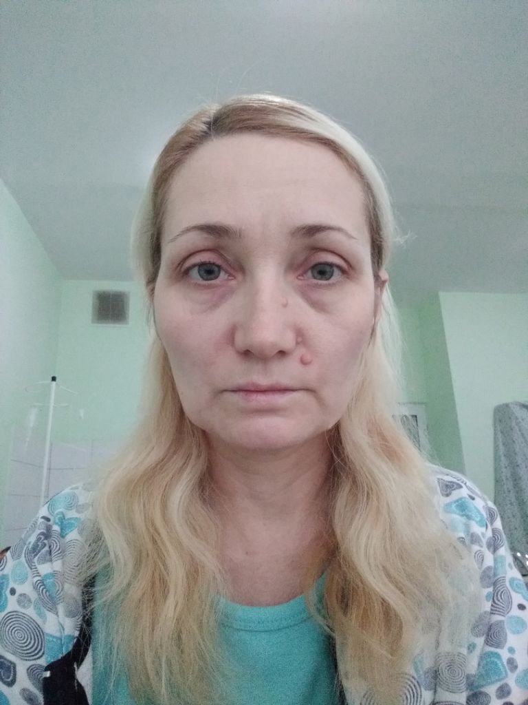 Фото для Сбор средств на лечение онкологии