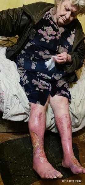 Фото для Буду рада вашей помощи. , болею 