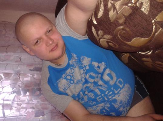 Фото для Только ЖИВИ Иван Парамонов!!! Саркома Юинга РЕЦИДИВ