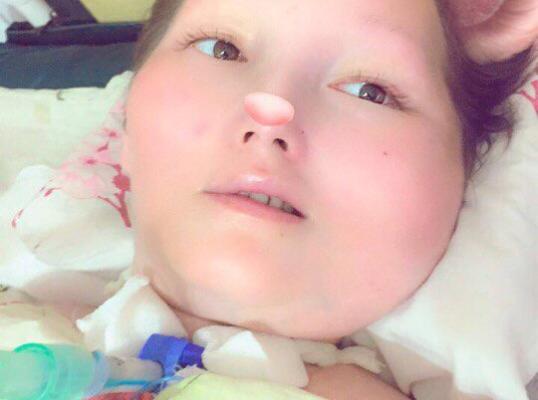 Фото для Мама полностью обездвиженна, на аппарате ИВЛ