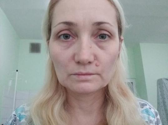 Фото для Сбор средств на лечение онкологии