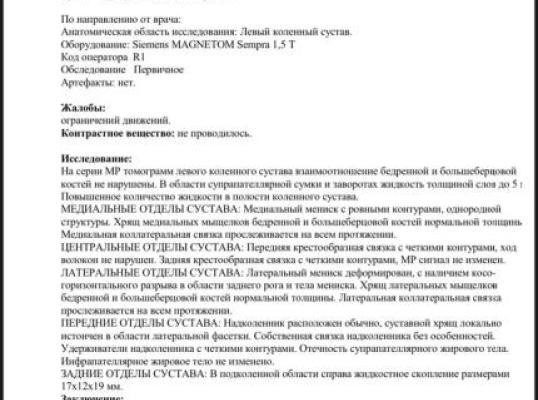 Фото для Помогите собрать на операцию коленного сустава 